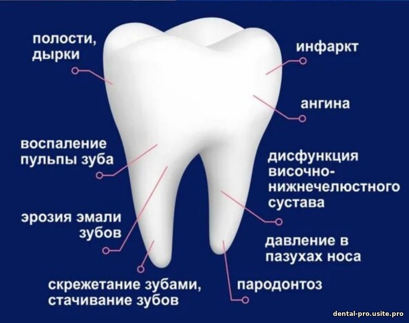 Почему болит зуб